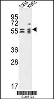 TBCE Antibody (Center)