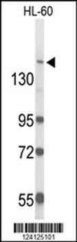RAB3GAP2 Antibody (C-term)