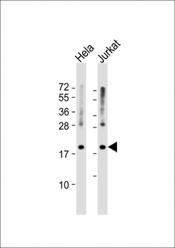 RPS11 Antibody (Center)