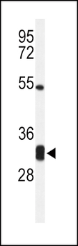 CPSF4 Antibody (Center)