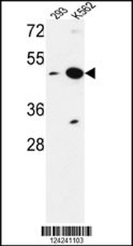 NUPL2 Antibody (N-term)