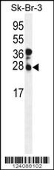 CHMP4B Antibody (N-term)