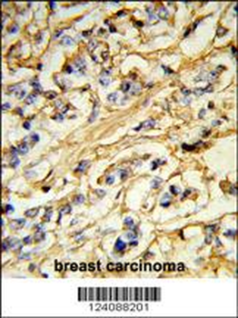 CHMP4B Antibody (N-term)