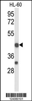 TNFRSF10D Antibody (Center)