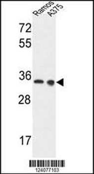 LDHA Antibody (Center)