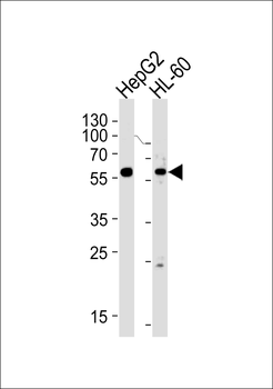 FANCC Antibody (C-term)