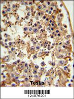 FANCC Antibody (C-term)