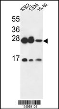ANP32A Antibody (C-term)