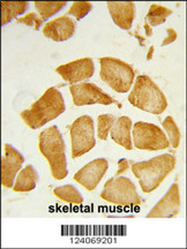 ANP32A Antibody (C-term)