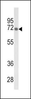 GBE1 Antibody (Center)