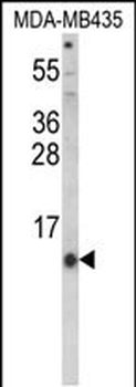 HAMP Antibody (Center)