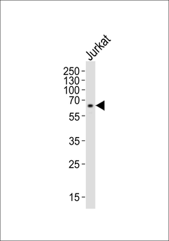 IL2RG Antibody (N-term)