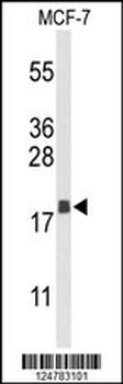 AGR3 Antibody (C-term)