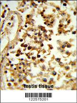 IL31 Antibody (N-term)