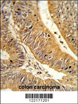 CXXC4 Antibody (C-term)