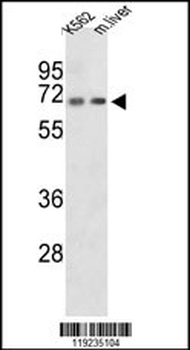 CROT Antibody (N-term)