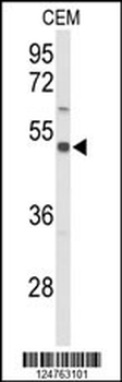 S39A8 Antibody (Center)