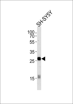 GPM6A Antibody (C-term)