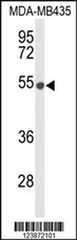 DMC1 Antibody (N-term)