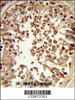 DMC1 Antibody (N-term)