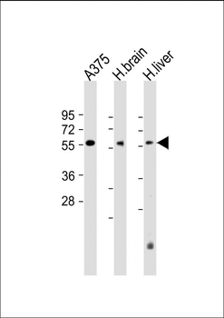 DLL3 Antibody (C-term)