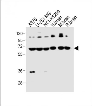 DLL3 Antibody (C-term)