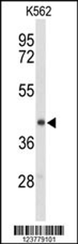 ENTPD2 Antibody (N-term)