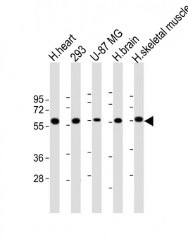 ENTPD2 Antibody (N-term)