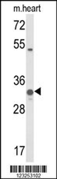COQ5 Antibody (Center)
