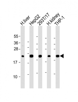 GPX1 Antibody (C-term)
