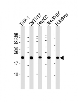 GPX1 Antibody (C-term)