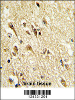 MOUSE VGLU2 Antibody (C-term)