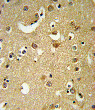 GABRA2 Antibody (C-term)