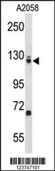 EFTUD2 Antibody (Center)