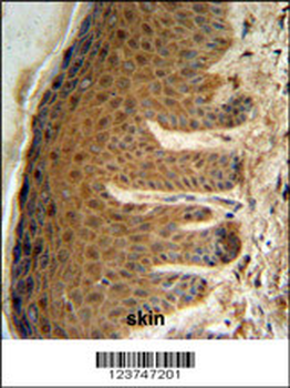 EFTUD2 Antibody (Center)