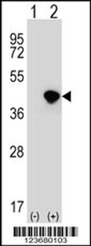 DFFA Antibody (C-term)