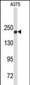 TOP2A Antibody (C-term)