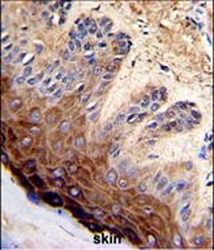 TOP2A Antibody (C-term)