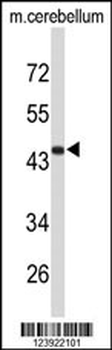 FMOD Antibody (C-term)