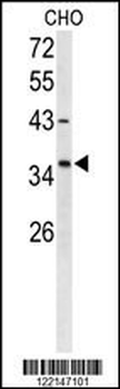 FOXL1 Antibody (Center)