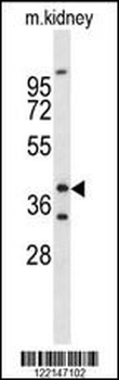 FOXL1 Antibody (Center)