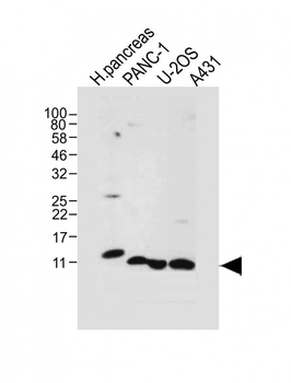 REG3A Antibody (N-term)