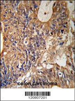 GSTP1 Antibody (Center)
