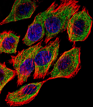 GSTP1 Antibody (Center)