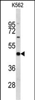 EIF4A2 Antibody (C-term)