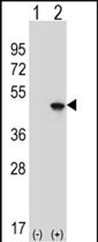 EIF4A2 Antibody (C-term)