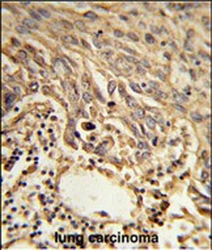 EIF4A2 Antibody (C-term)