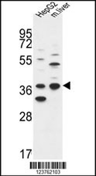 DHRS3 Antibody (Center)