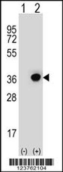 DHRS3 Antibody (Center)