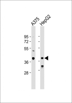 DHRS3 Antibody (Center)